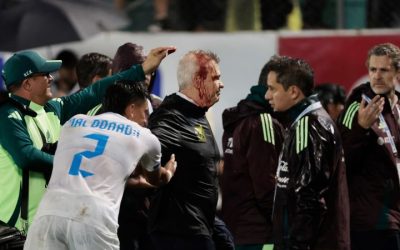 Mexico soccer manager Javier Aguirre struck by can thrown onto the pitch from stands, left with bloodied head | CNN