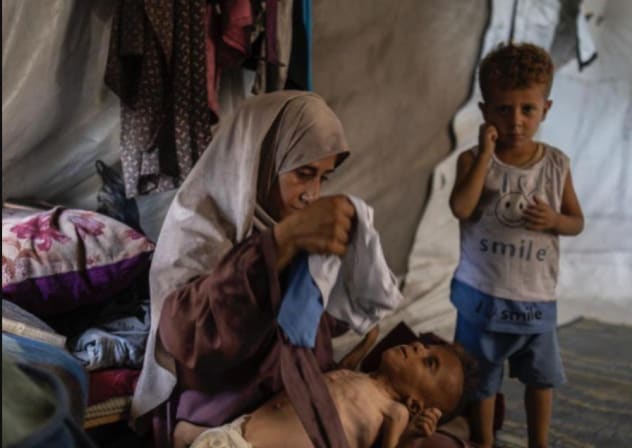 Child Muhammad Zakariya Ayyoub al-Matouq, who suffers from cerebral palsy, alongside mother and brother. 